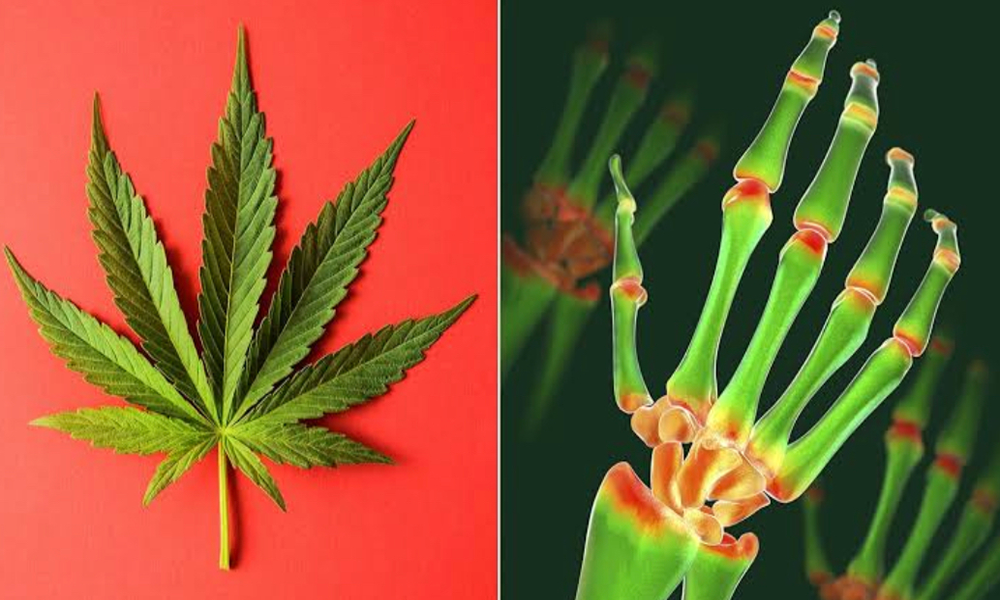 医療大麻と膠原病・リウマチ性疾患