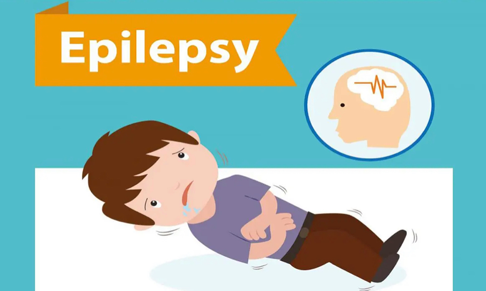 てんかんとCBD・医療用大麻