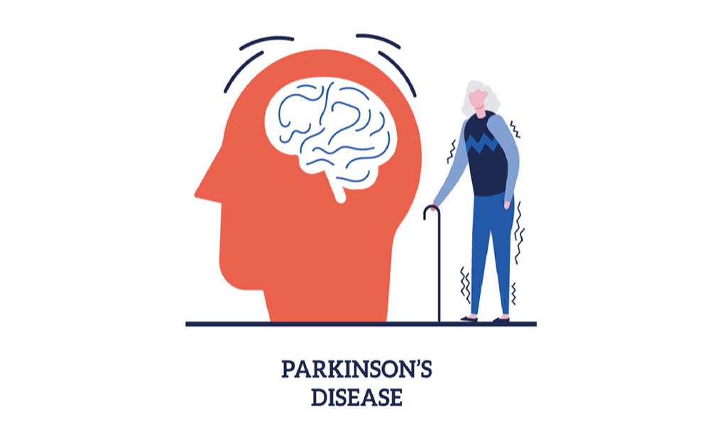 パーキンソン病とCBD・医療用大麻